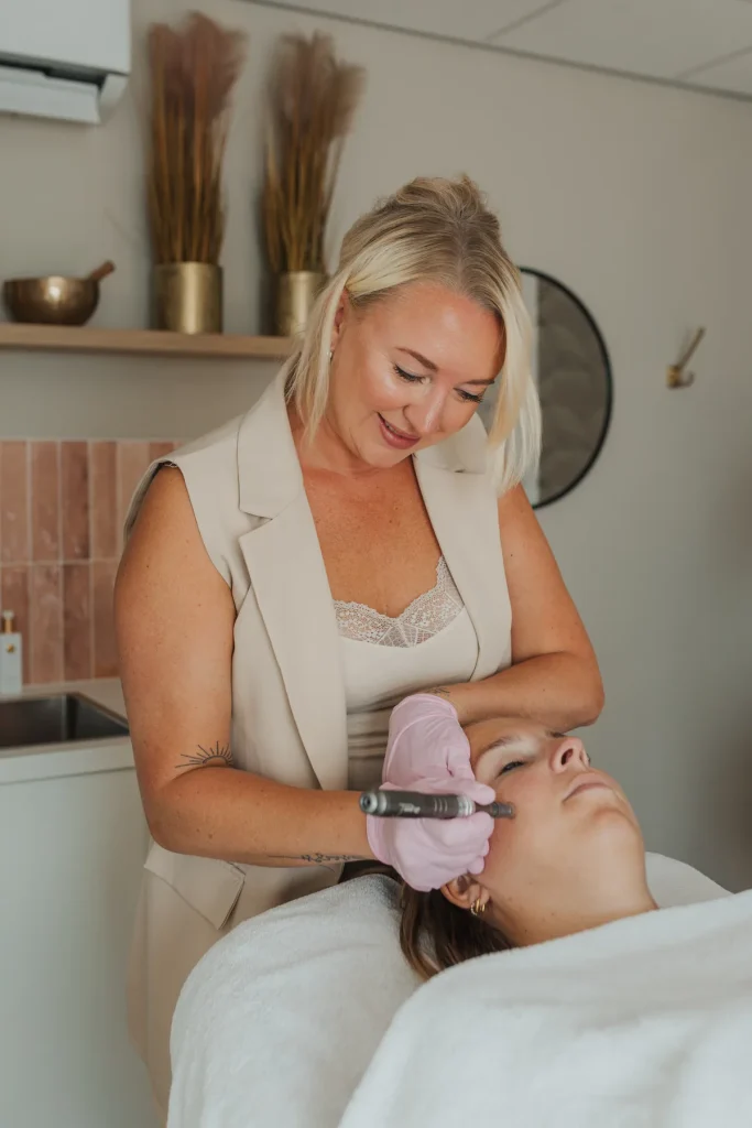 Microneedling behandeling bij Soul of Skin in Naaldwijk