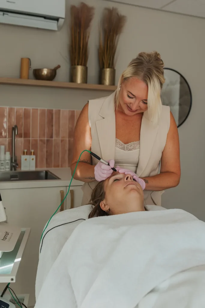 Plekjes verwijderen bij Soul of Skin in Naaldwijk